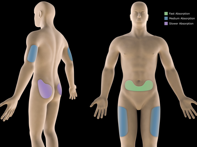 Diagram of a human figure showing insulin injection sites: upper arms (blue), abdomen (green), thighs (blue), and buttocks (purple), labeled by absorption rates—fast (green), medium (purple), slower (blue).