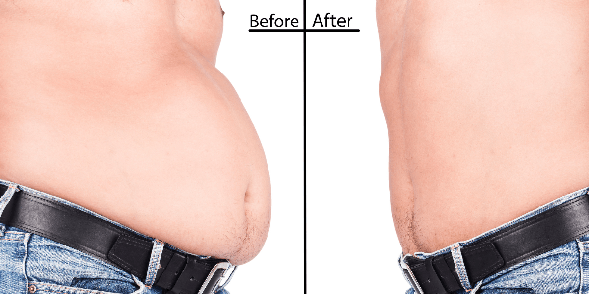 Before and after weight loss