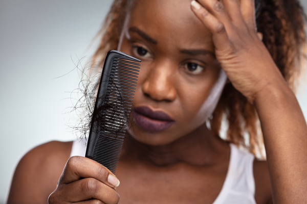 a woman with Minoxidil Hair Shedding