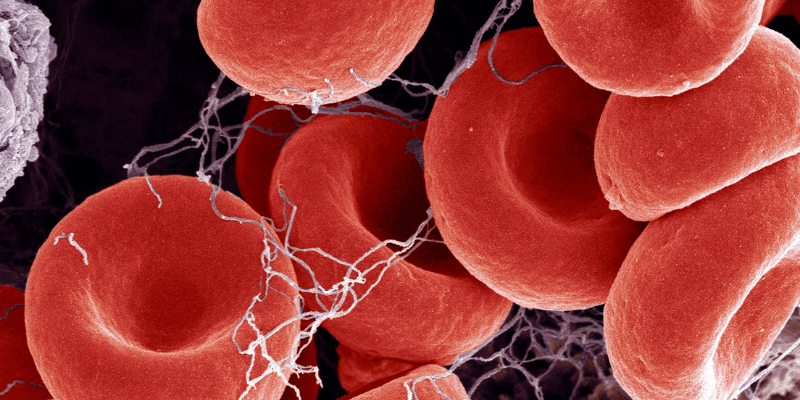 Close-up of red blood cells and fibrin.