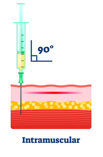 vitamin b12 injection site -intramuscular