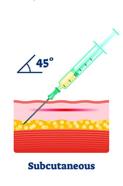 administering b12 shots - subcutaneous