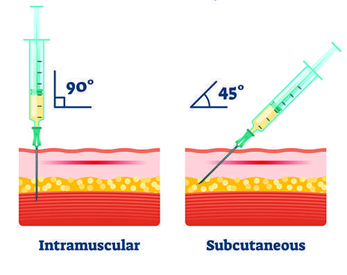 How to inject at 90 degrees and 45 degrees
