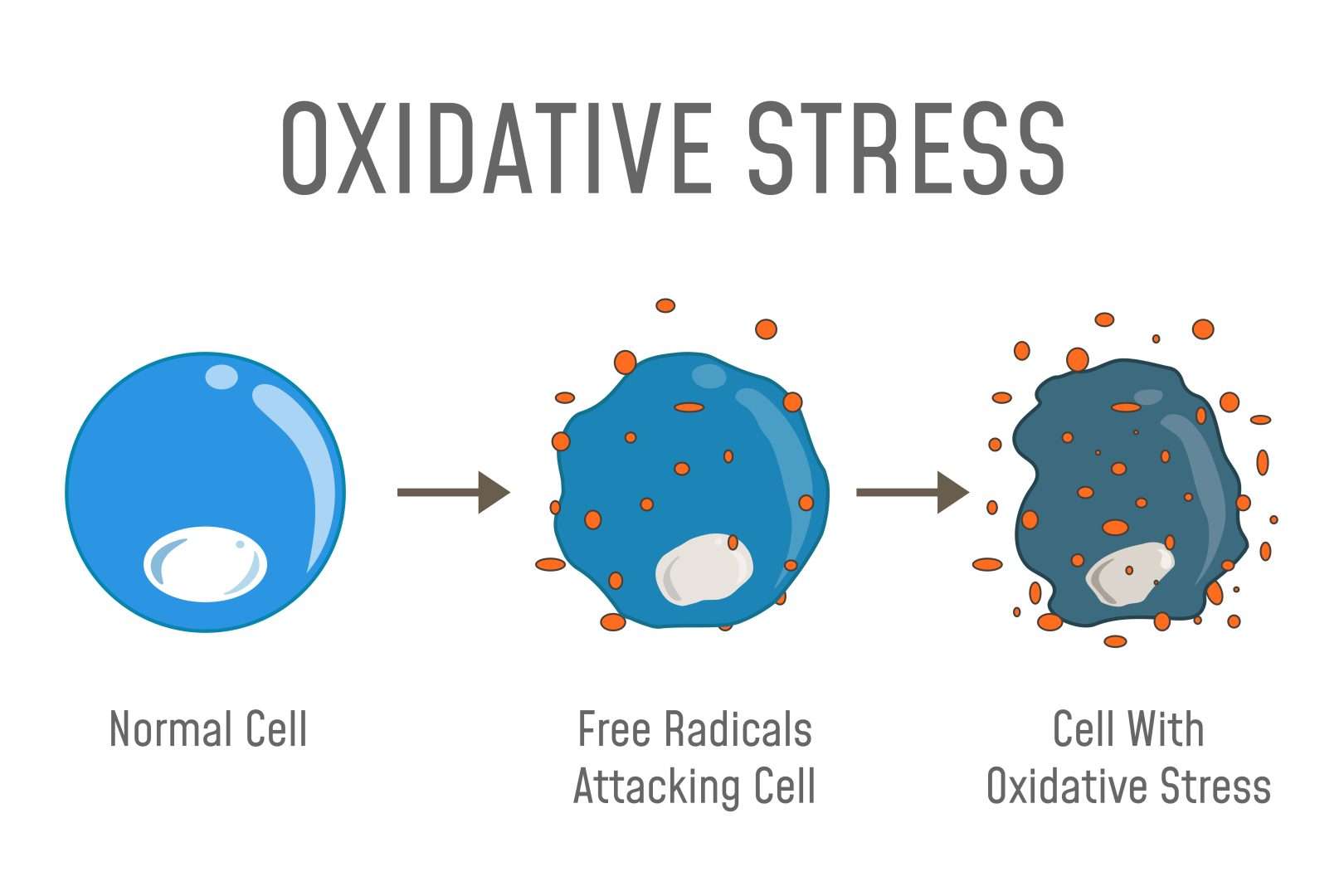 A picture of Oxidative Stress